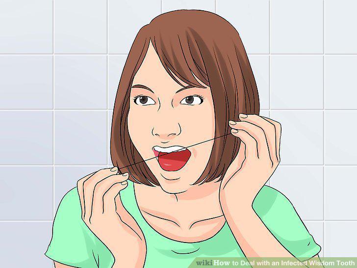 Step 13