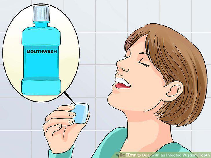 Step 14