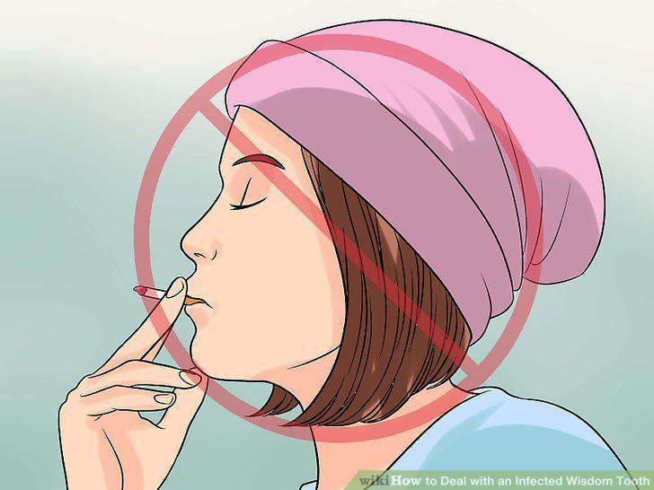 Step 16