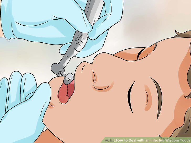 Step 9
