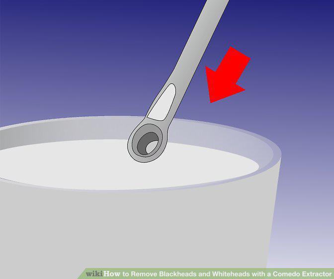 Step 5