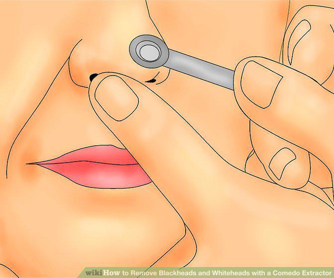 Step 6