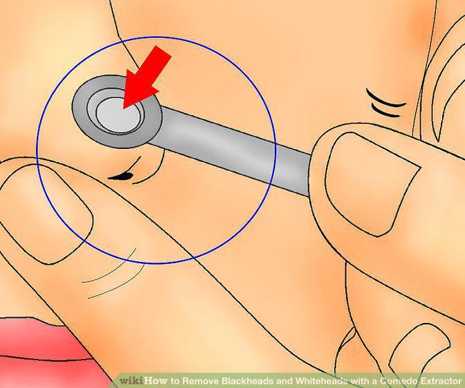 Step 7