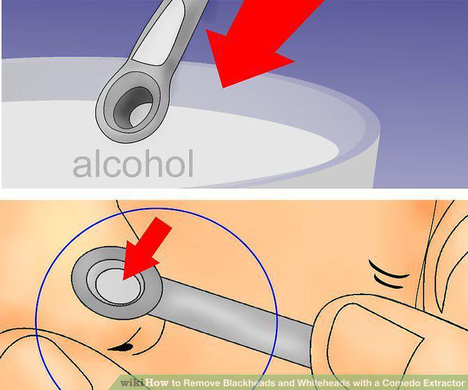 Step 8