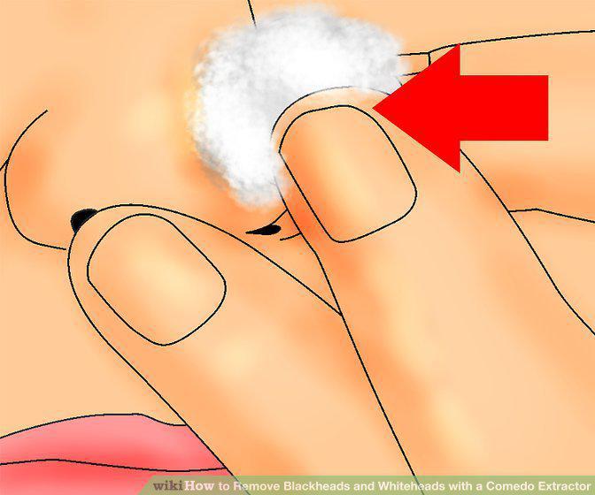 Step 9