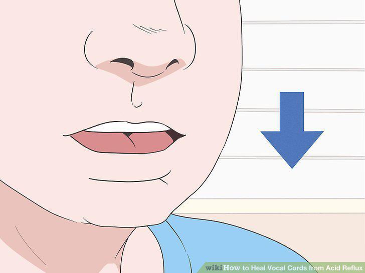 Step 5