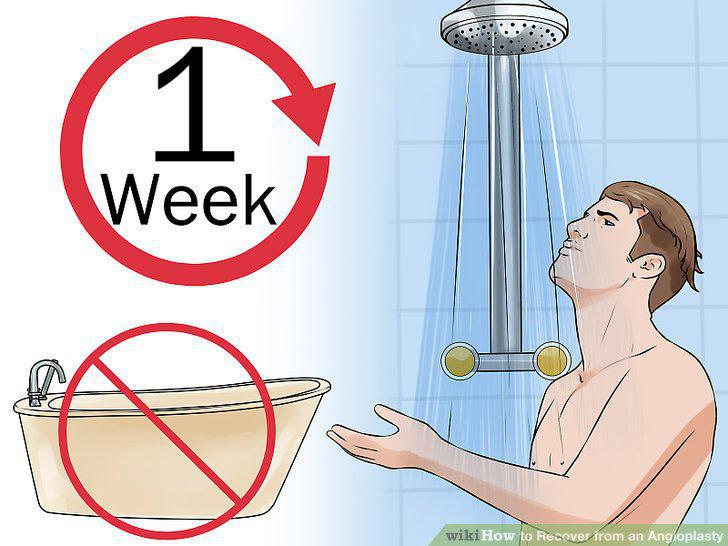 Step 11