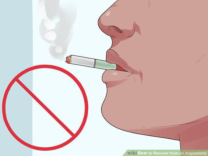 Step 14