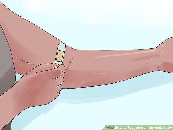 Step 9