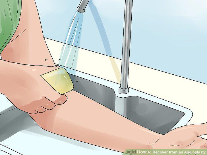 Step 10
