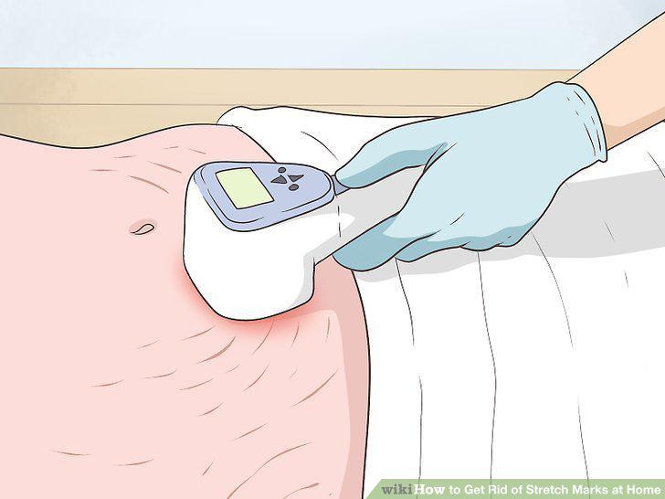 Step 12