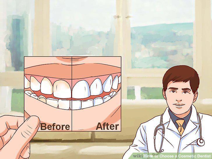Step 11