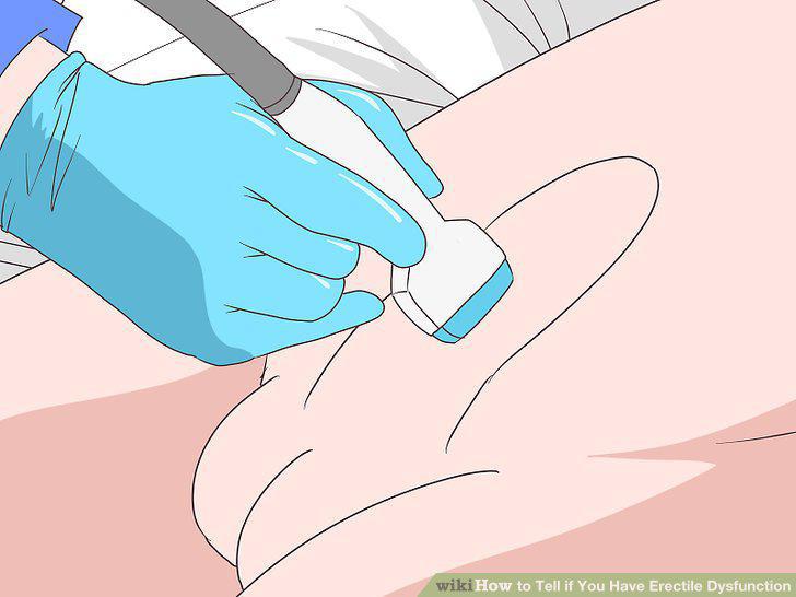 Step 9