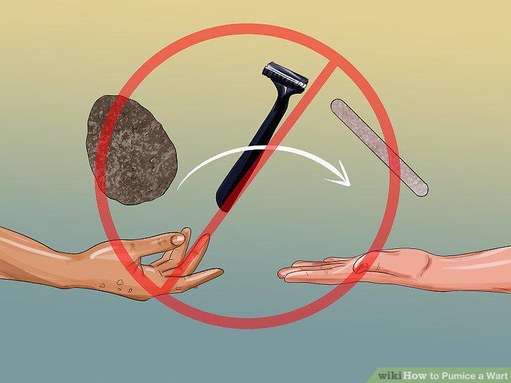 Step 11