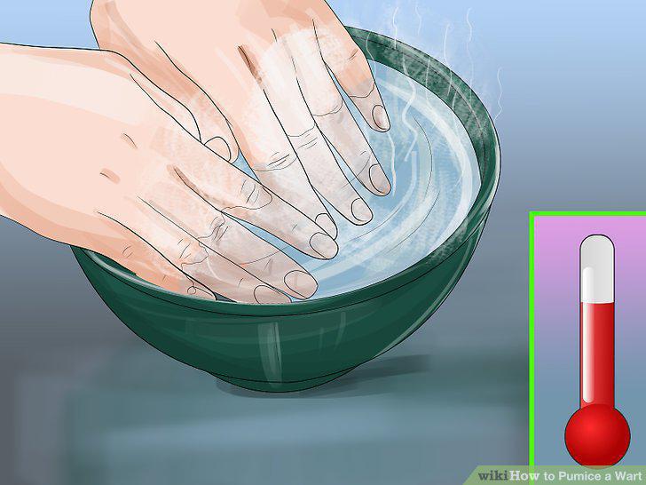 Step 5