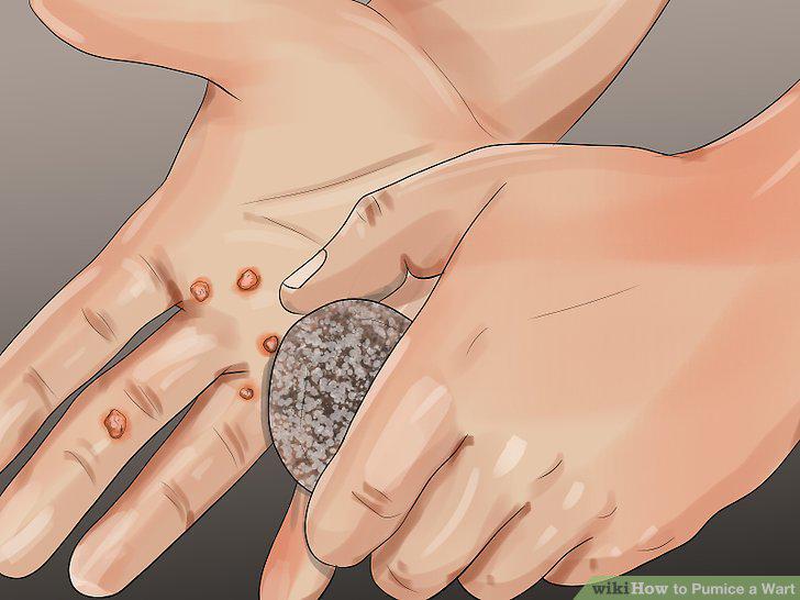 Step 6