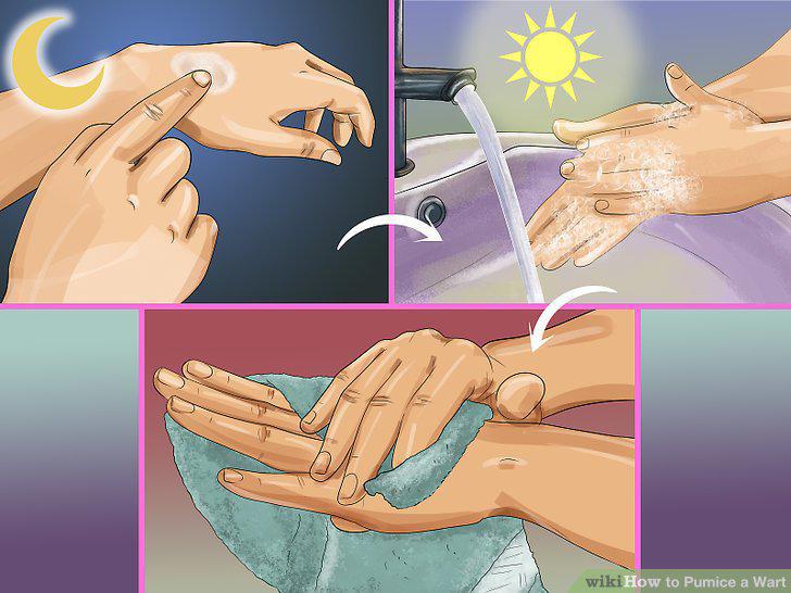 Step 7