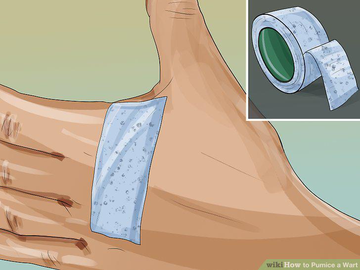 Step 8