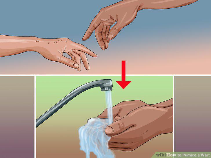 Step 9