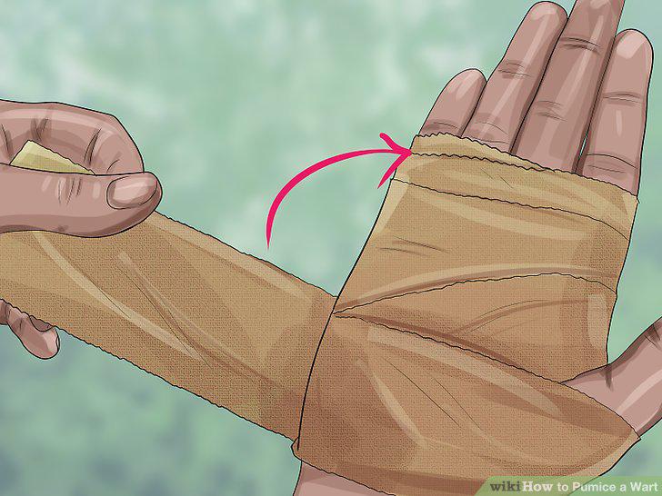 Step 10