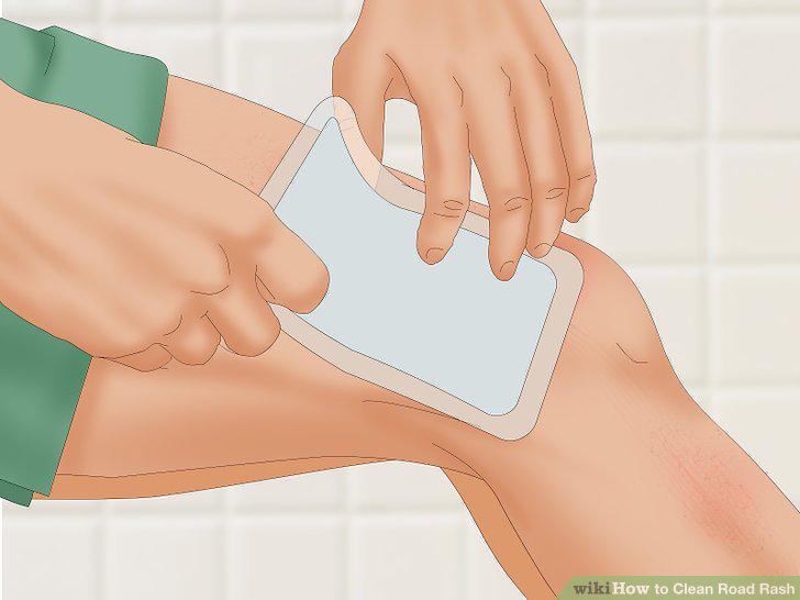 Step 12