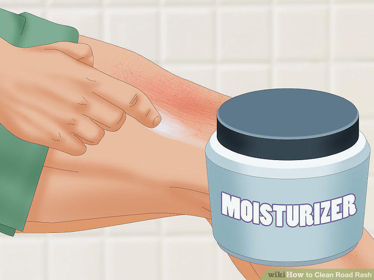 Step 15