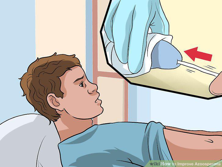 Step 10