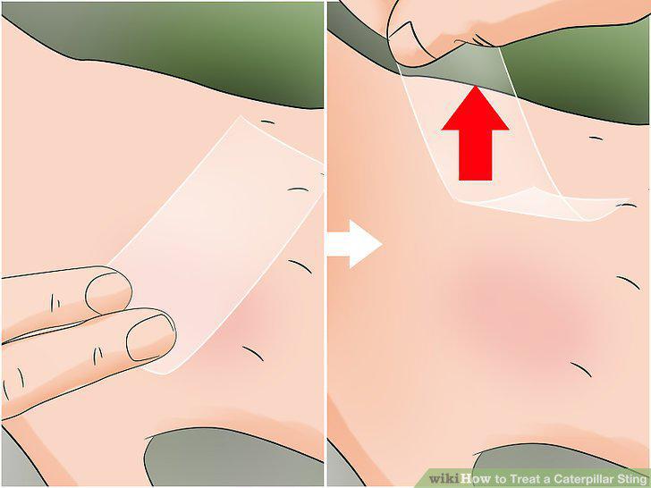 Step 2