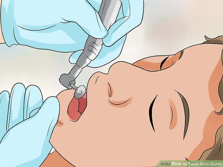 Step 10