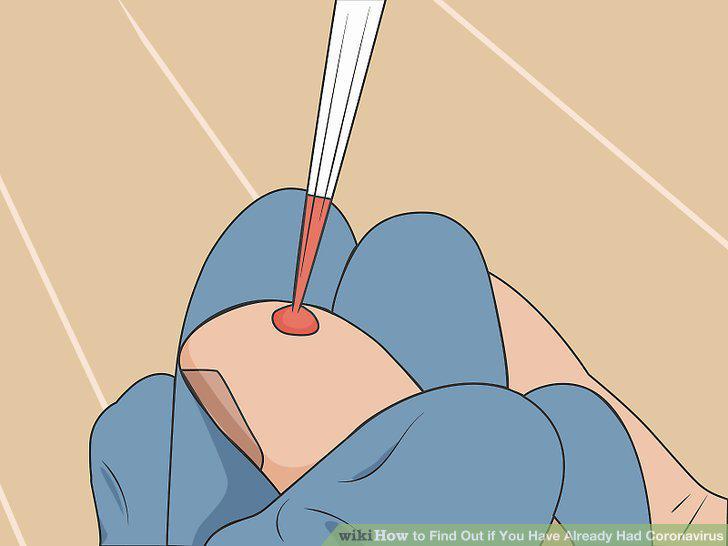 Step 5