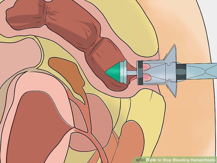 Step 12