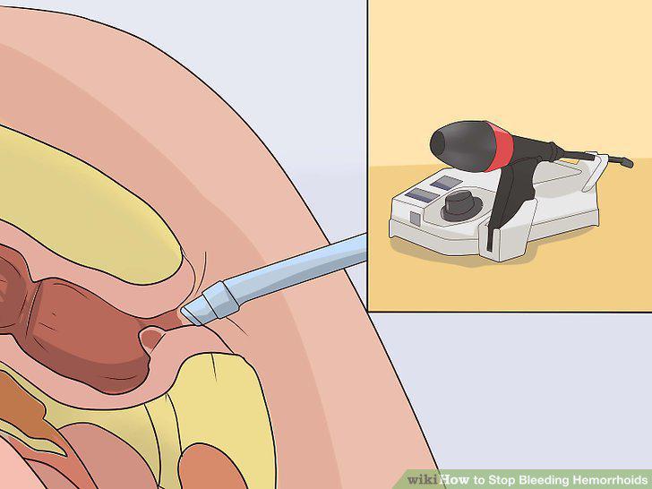 Step 10