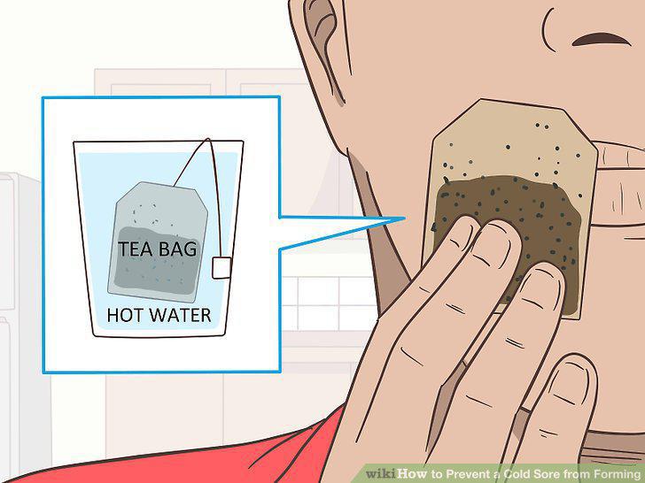 Step 12