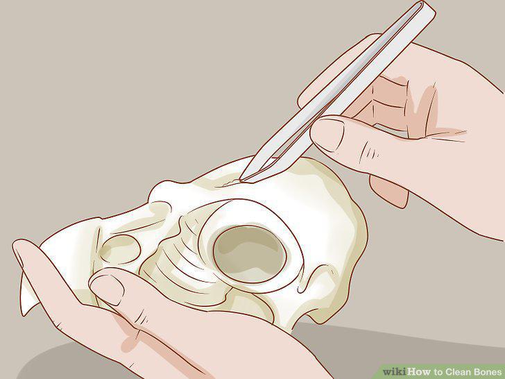 Step 14