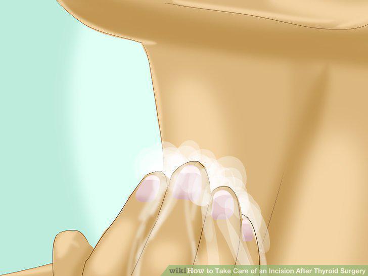 Step 2