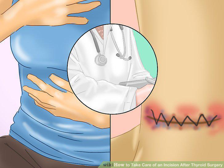 Step 11