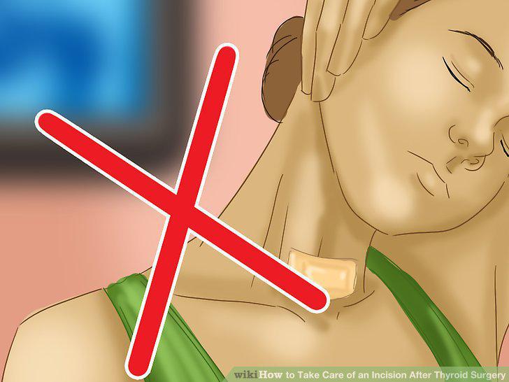 Step 10