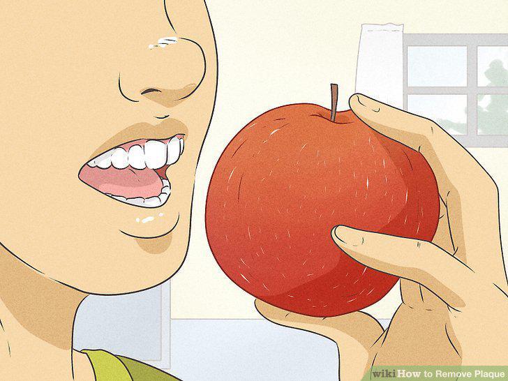 Step 12