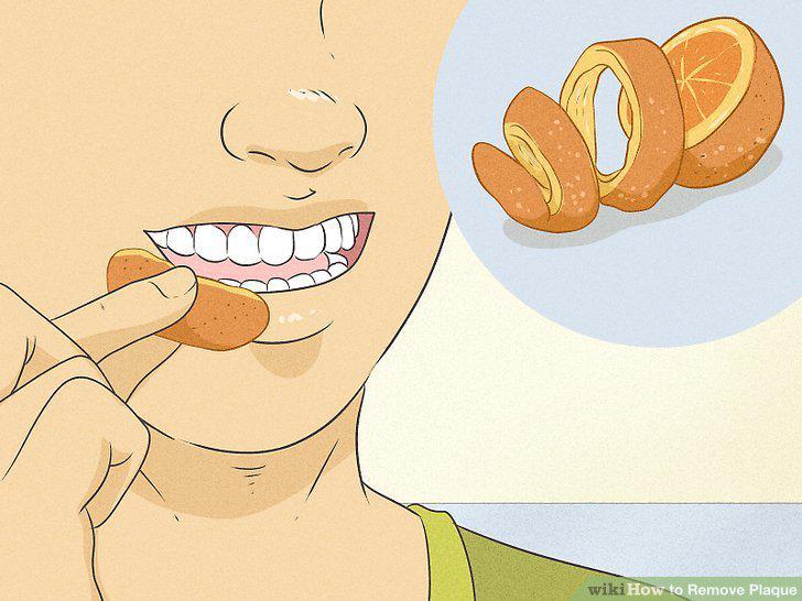 Step 13