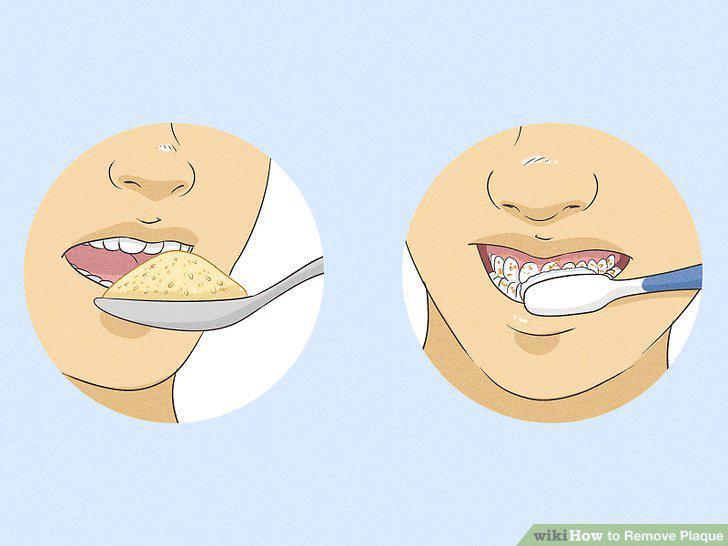 Step 14