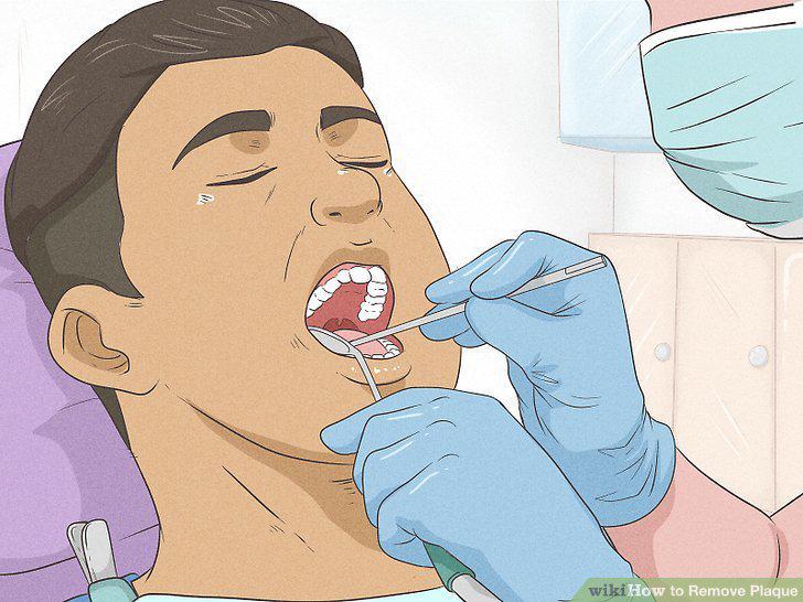 Step 10