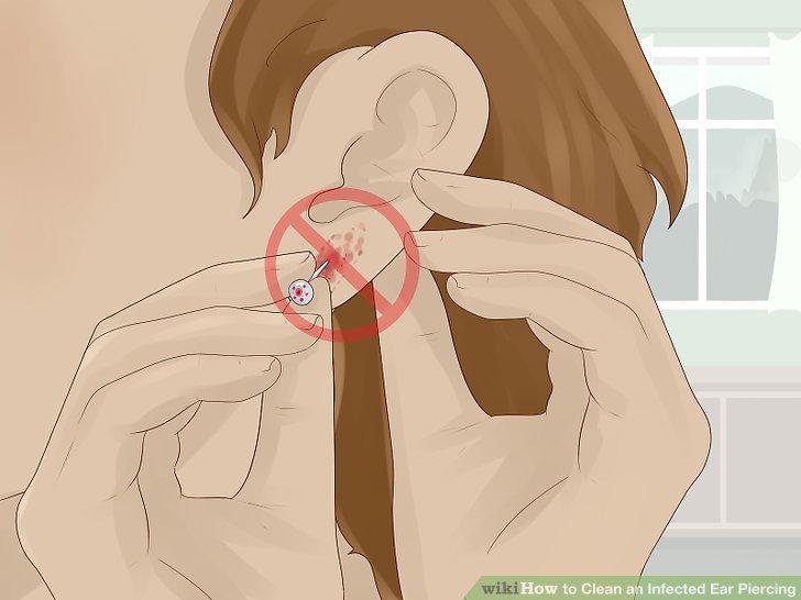 Step 2