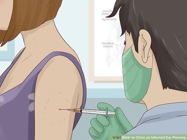 Step 10