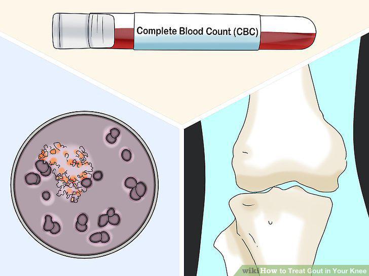 Step 14