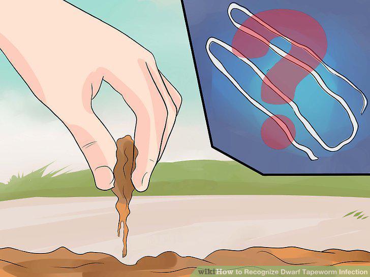 Step 10