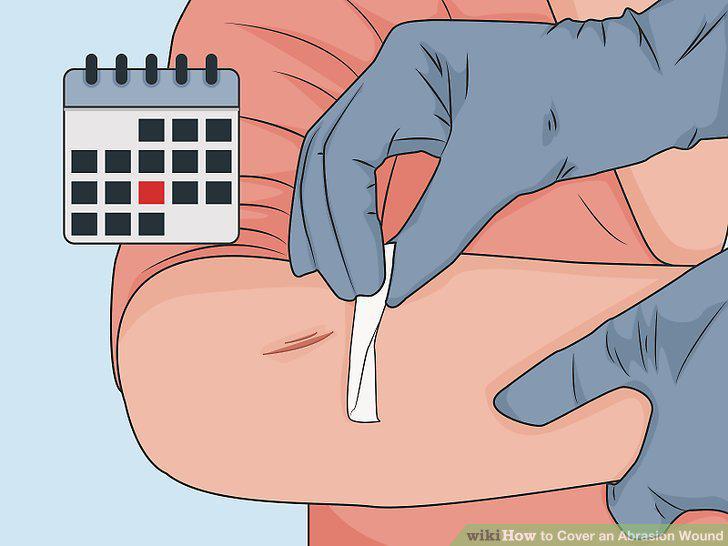 Step 13