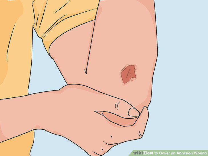 Step 14