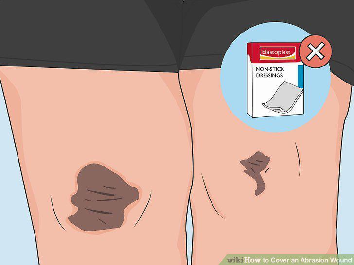 Step 15