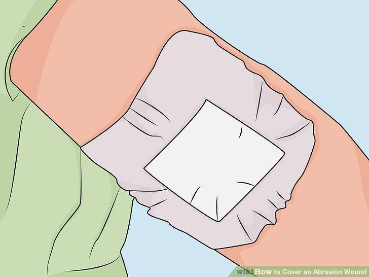 Step 10
