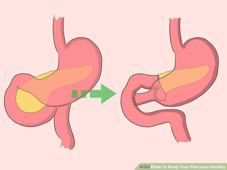 Step 16